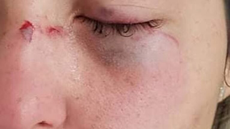 Para se defender mulher mata marido a facada em MS