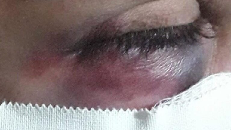 DOURADOS – Homem tenta esfaquear esposa mas é salva por vizinhos