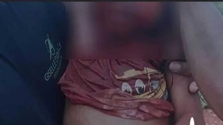 Garotinha de 4 anos é atacada por cachorro em Aldeia e esta em estado grave