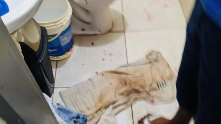 Estrela Porã – Mais uma briga entre irmãos caba com um gravemente ferido a facadas em Dourados