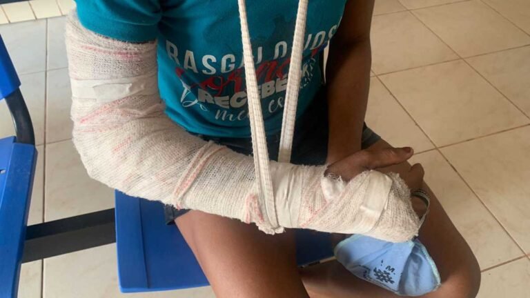 Marido e preso após quebrar braço de esposa durante agressões em MS