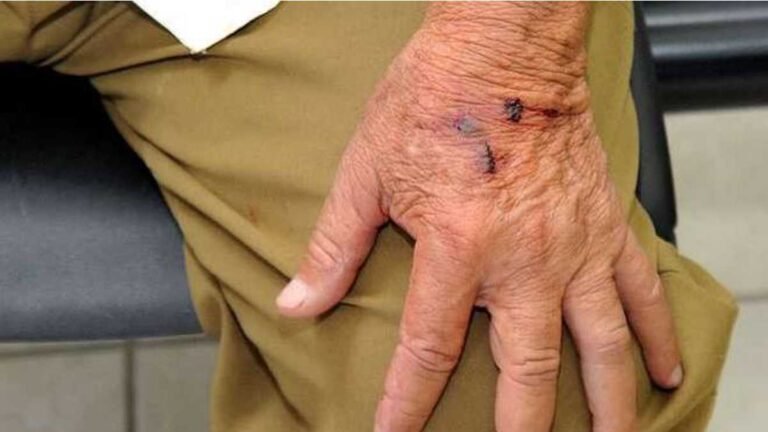 Idoso é espancado dentro de casa suspeito de abuso contra uma criança em MS