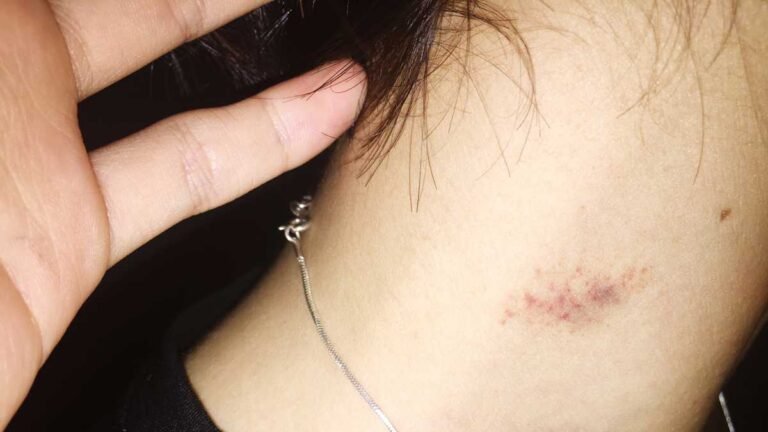 Mãe percebe abuso por parte de avô contra menina de 9 anos após ver chupão em pescoço da criança