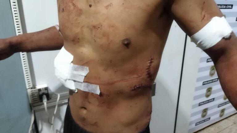 Jaguapirú – Armados com facão, dois jovens se agridem, duas pessoas vão parar no hospital e uma vai presa