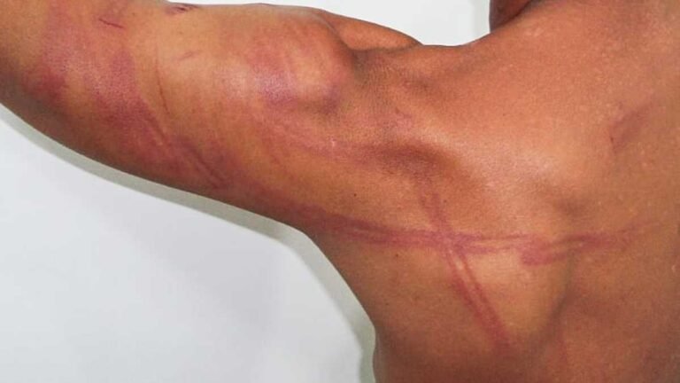 Homem é agredido a cadeiradas pela ex-companheira após ela descobrir que o ex tem atual