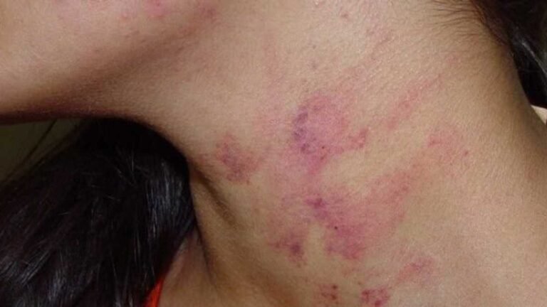 Mulher é levada para UPA após marido espanca-la com socos