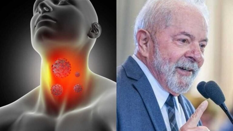 Lula é internado e fez cirurgia para retirada de lesão na laringe