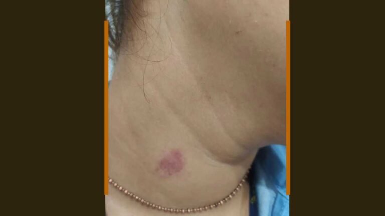 Sem consentimento colega de trabalho da um “chupão” no pescoço de mulher e é preso por importunação sexual