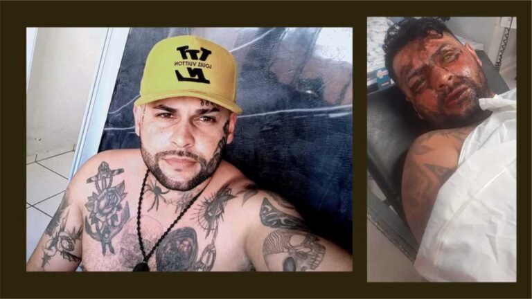 Tatuador perde a visão por ter soda cáustica jogada em rosto e precisa de ajuda financeira