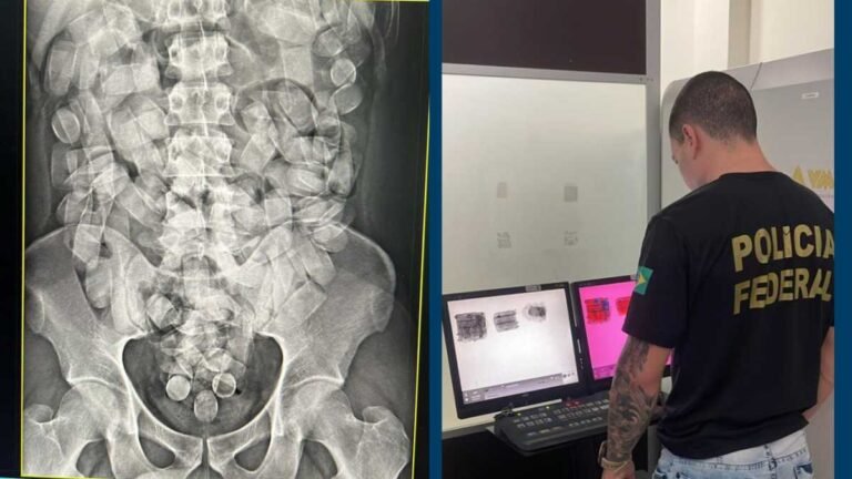 Estomago cheio – PF prende passageiro no aeroporto tranportando cocaina no estomago