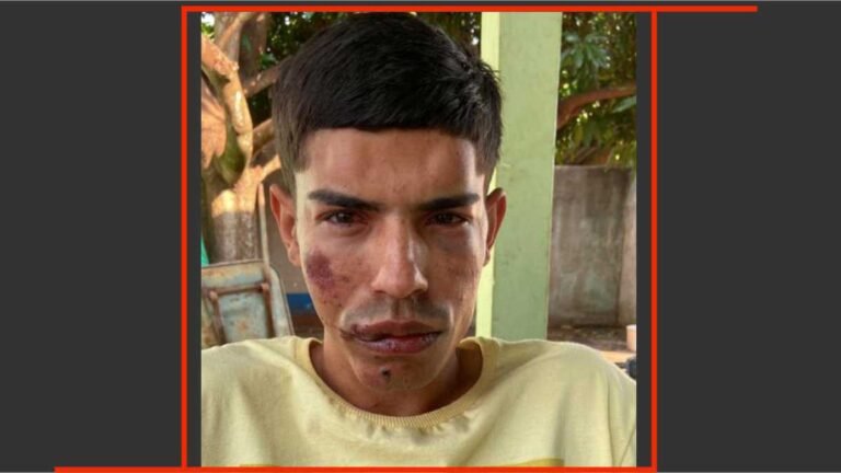 Assassin0 de médico é balead0 em tentativa de fuga e m0rre no HV