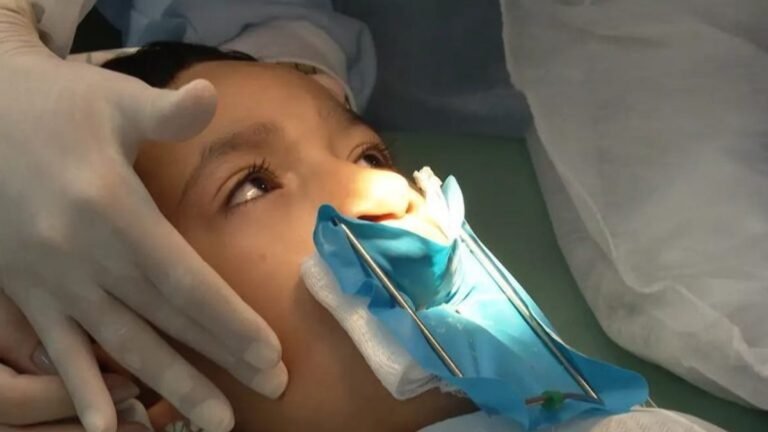 Lula sanciona lei que oferta cirurgia reconstrutiva de lábio leporino no SUS