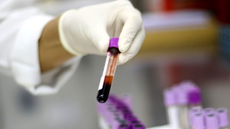 Ministério da Saúde descarta caso de gripe aviária em um trabalhador do RS