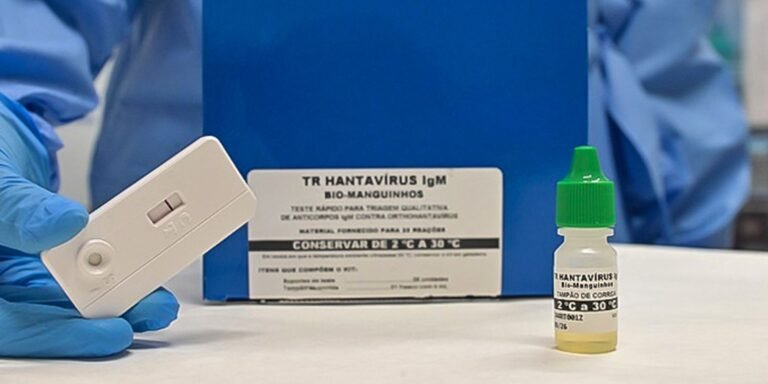 Teste inovador diagnostica hantavirose em apenas 20 minutos