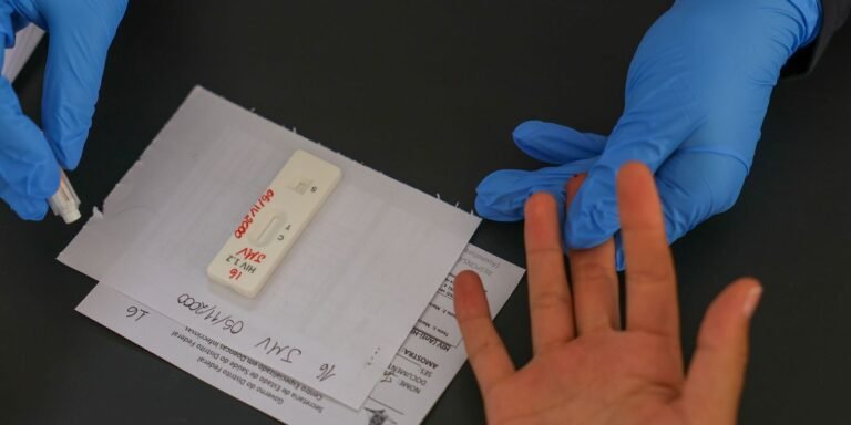 Brasil insiste em acordo para acesso à PrEP de longa duração contra HIV/Aids