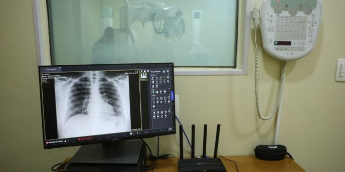 Hospital radiology workstation with chest X-ray visible on the monitor, a wireless router on the desk, and a wall-mounted medical terminal in the background.