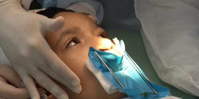 Patient undergoing a dental procedure with mouth retractor and blue drape, gloved hands stabilizing the jaw.