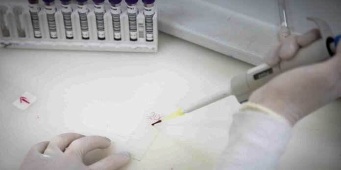 Scientist wearing gloves uses a pipette to apply liquid onto a small sample on a glass slide with a rack of labeled vials in the background.