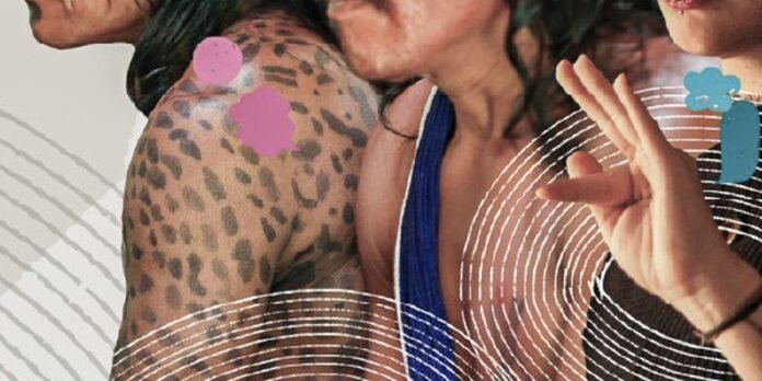 Close-up of a tattooed arm with leopard-print pattern and white concentric arc graphics overlaid on the image.