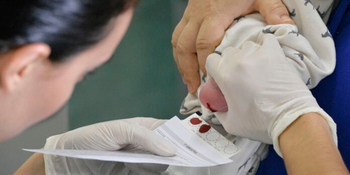Gloved clinician examines a baby's forearm, placing a small bandage while holding a test card with circular samples.