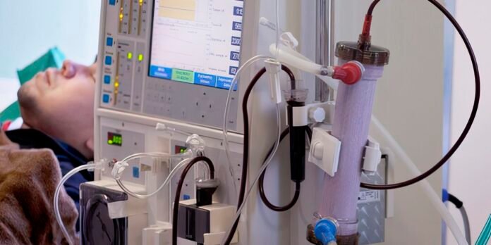 Patient lying down with a dialysis machine connected via tubes and monitoring screens nearby, in a hospital room.