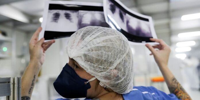Healthcare worker in a hairnet and mask holds up two X-ray film sheets in a bright medical facility.