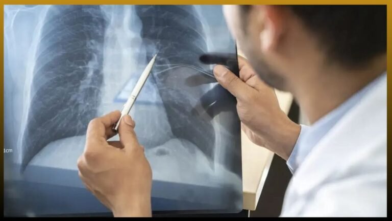 Anvisa aprova novo remédio para tratar câncer de pulmão avançado