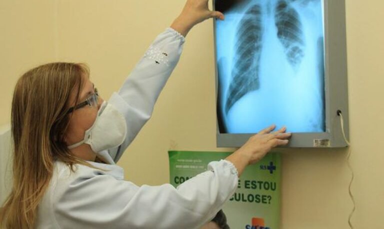 Prefeitura capacita equipes de saúde após aumento de casos de tuberculose em Dourados